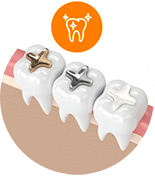White tooth Fillings